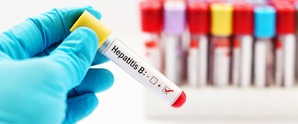 Kini Hepatitis B? Kini awọn aami aisan ati awọn ọna itọju?